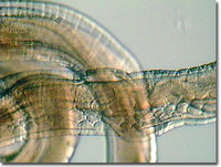 Male Whipworm
