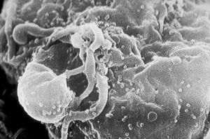 Scanning electron micrograph of HIV-1 budding from cultured lymphocyte.